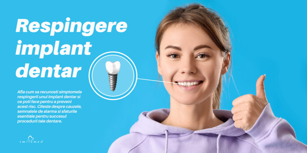 Afla cum sa recunosti simptomele respingerii unui implant dentar si ce poti face pentru a preveni acest risc. Citeste despre cauzele, semnalele de alarma si sfaturile esentiale pentru succesul procedurii tale dentare.